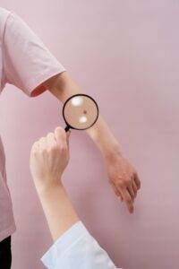 Дерматоскопія родимок у клініці MediBloom Київ